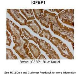 Antibody used in IHC on Human small intestine at: 1:300.