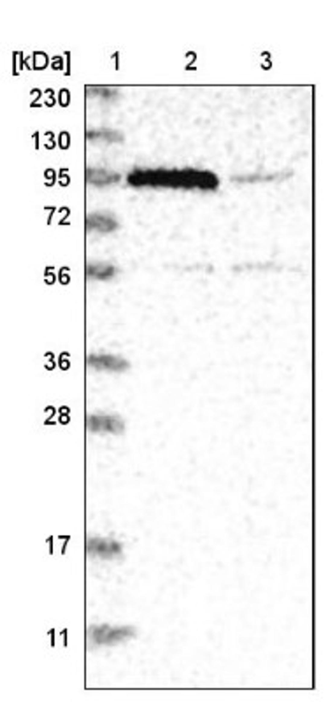 Western Blot: NSMAF Antibody [NBP1-84735] - Lane 1: Marker [kDa] 230, 130, 95, 72, 56, 36, 28, 17, 11<br/>Lane 2: Human cell line RT-4<br/>Lane 3: Human cell line U-251MG sp