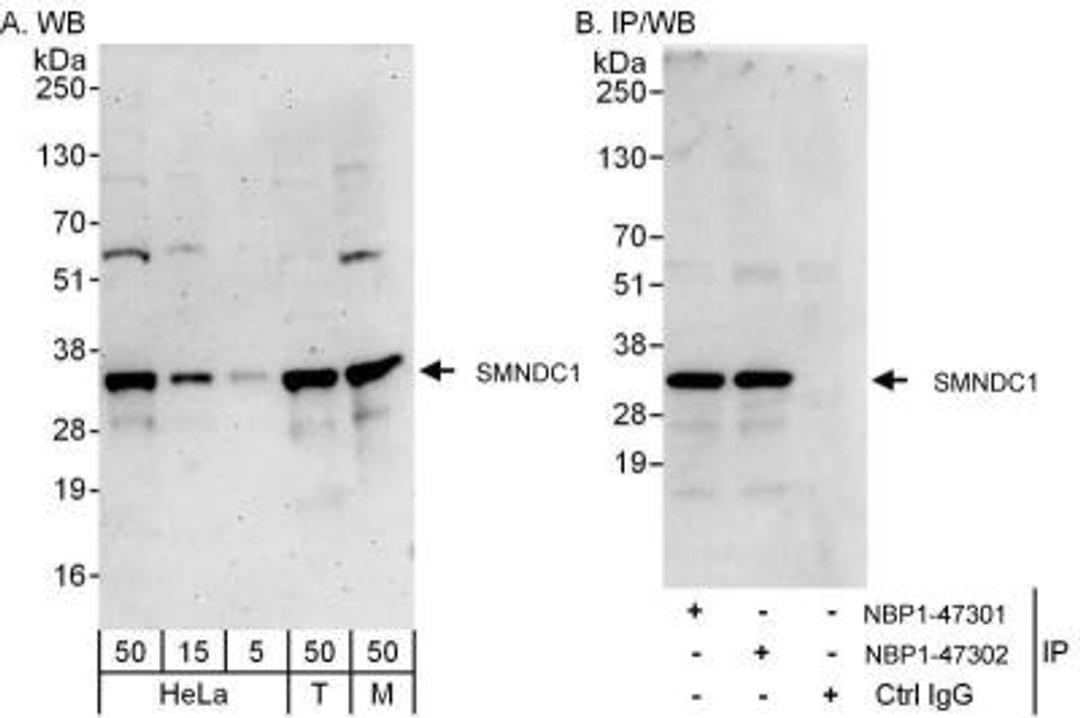 Western Blot: SMNDC1 Antibody [NBP1-47302] - Samples:  Whole cell lysate from HeLa (5, 15 and 50 ug for WB; 1 mg for IP, 20% of IP loaded), 293T (T; 50 ug), and mouse NIH3T3 (M; 50 ug) cells.  Antibodies: Affinity purified rabbit anti-SMNDC1 antibody NBP1-47302 used for WB at 0.1 ug/ml (A) and 1 ug/ml (B) and used for IP at 3 ug/mg lysate.  SPF30 was also immunoprecipitated by rabbit anti-SMNDC1 antibody NBP1-47301, which recognizes an upstream epitope.   Detection: Chemiluminescence with exposure times of 3 minutes (A) and 10 seconds (B).