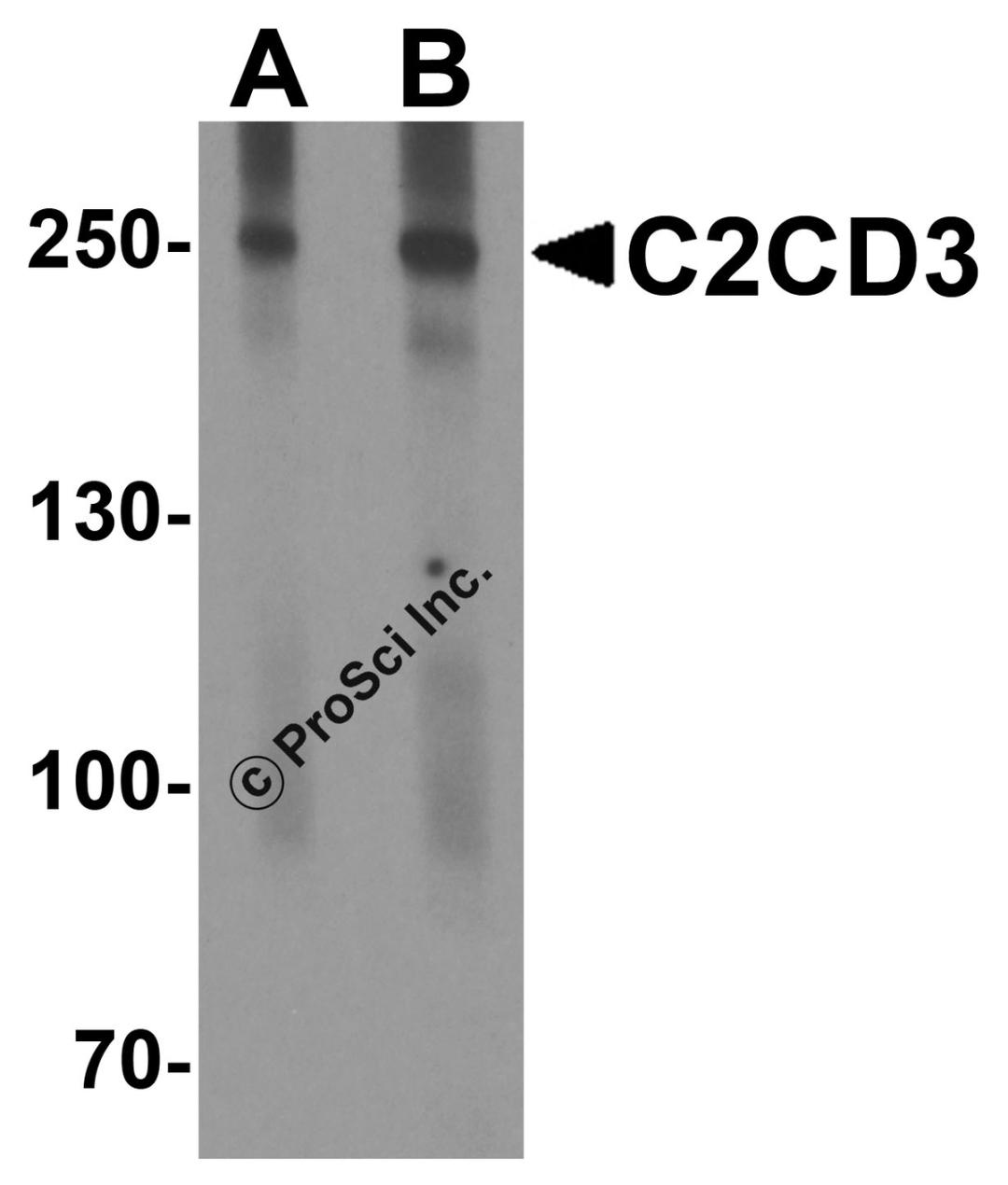 Western blot analysis of C2CD3 in EL4 cell lysate with C2CD3 antibody at (A) 1 and (B) 2 &#956;g/ml.