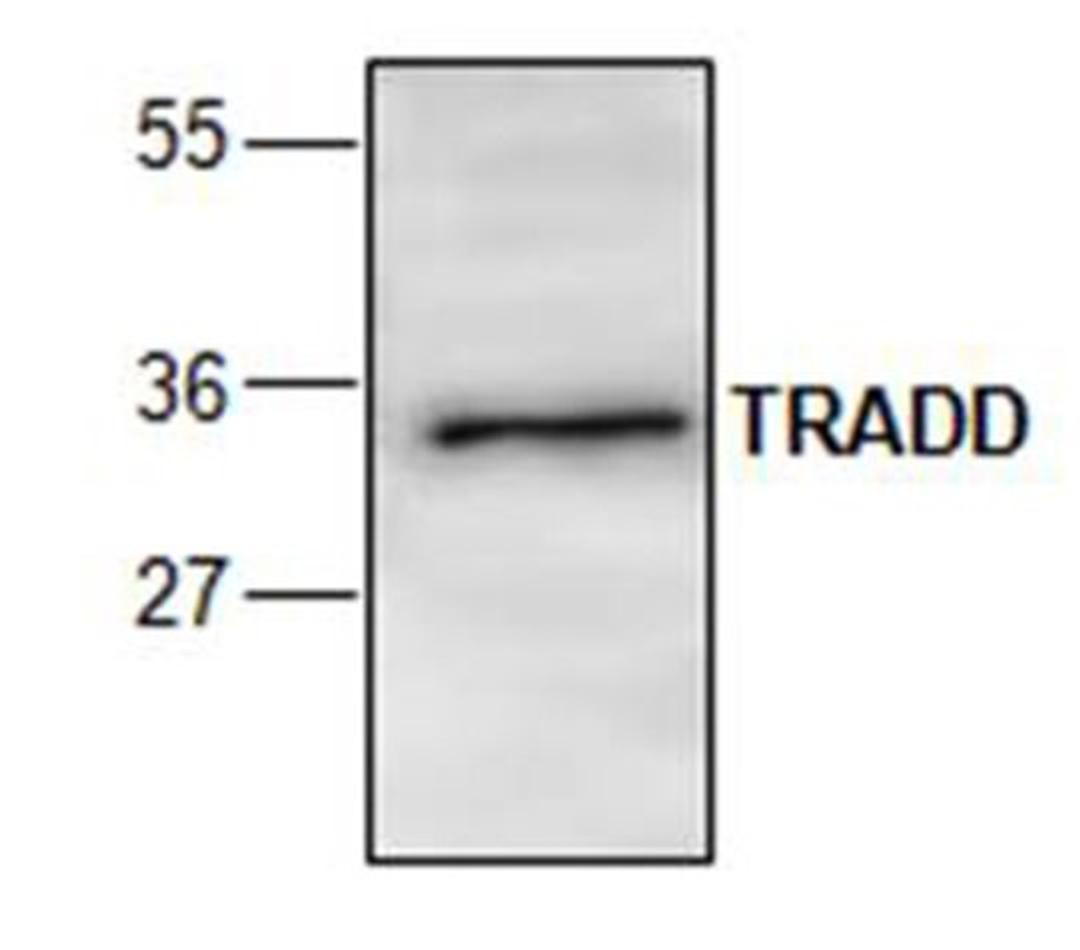 Western blot analysis of mouse small intestine tissue lysate probed with Rabbit anti TRADD antibody