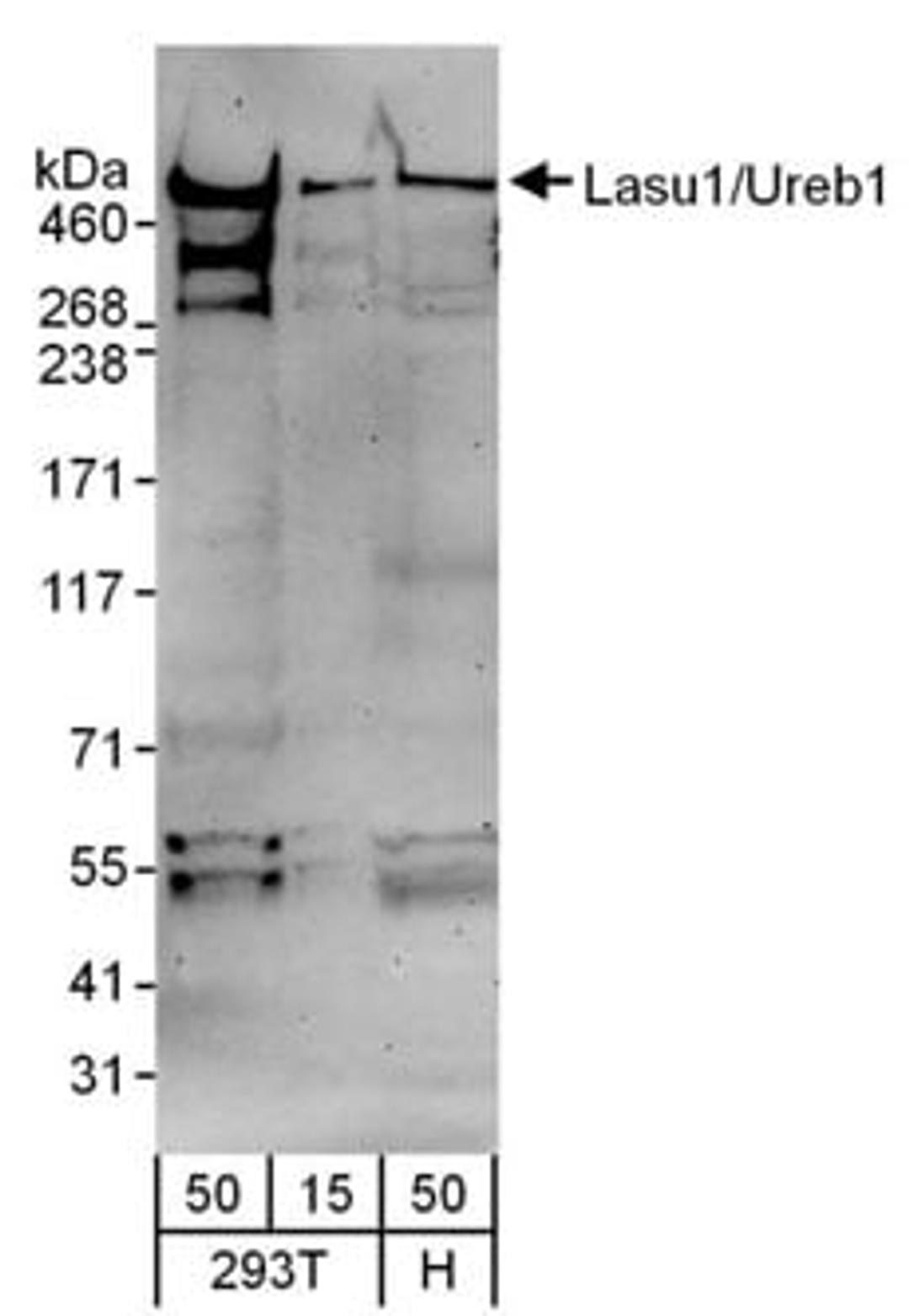 Detection of human Lasu1/Ureb1 by western blot.