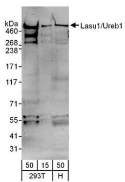 Detection of human Lasu1/Ureb1 by western blot.