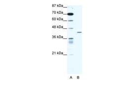 Antibody used in WB on Human Jurkat 1.25 ug/ml.