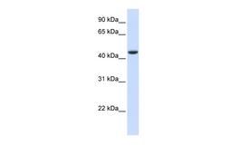 Antibody used in WB on Human Muscle at 0.2-1 ug/ml.