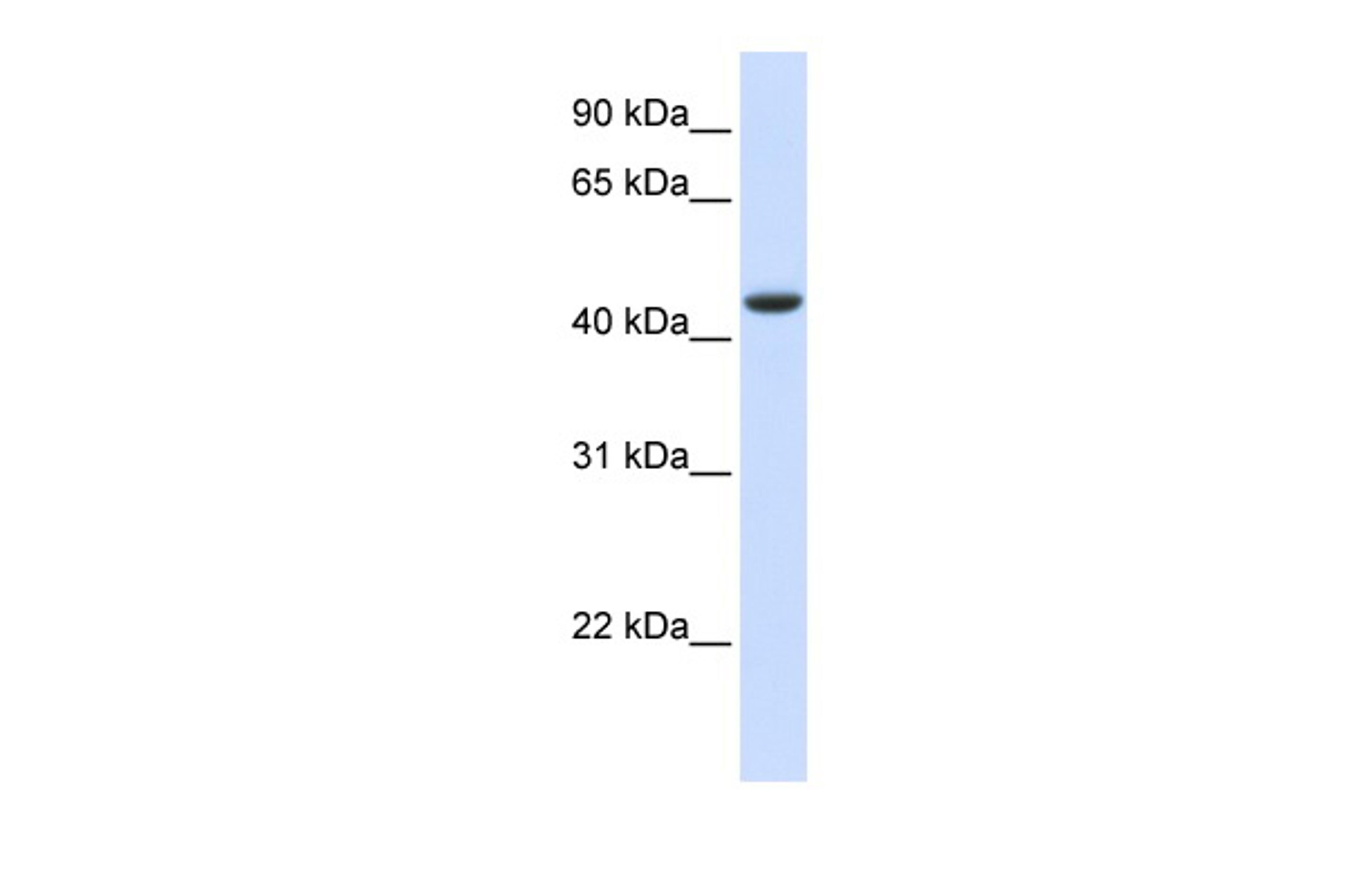 Antibody used in WB on Human Muscle at 0.2-1 ug/ml.