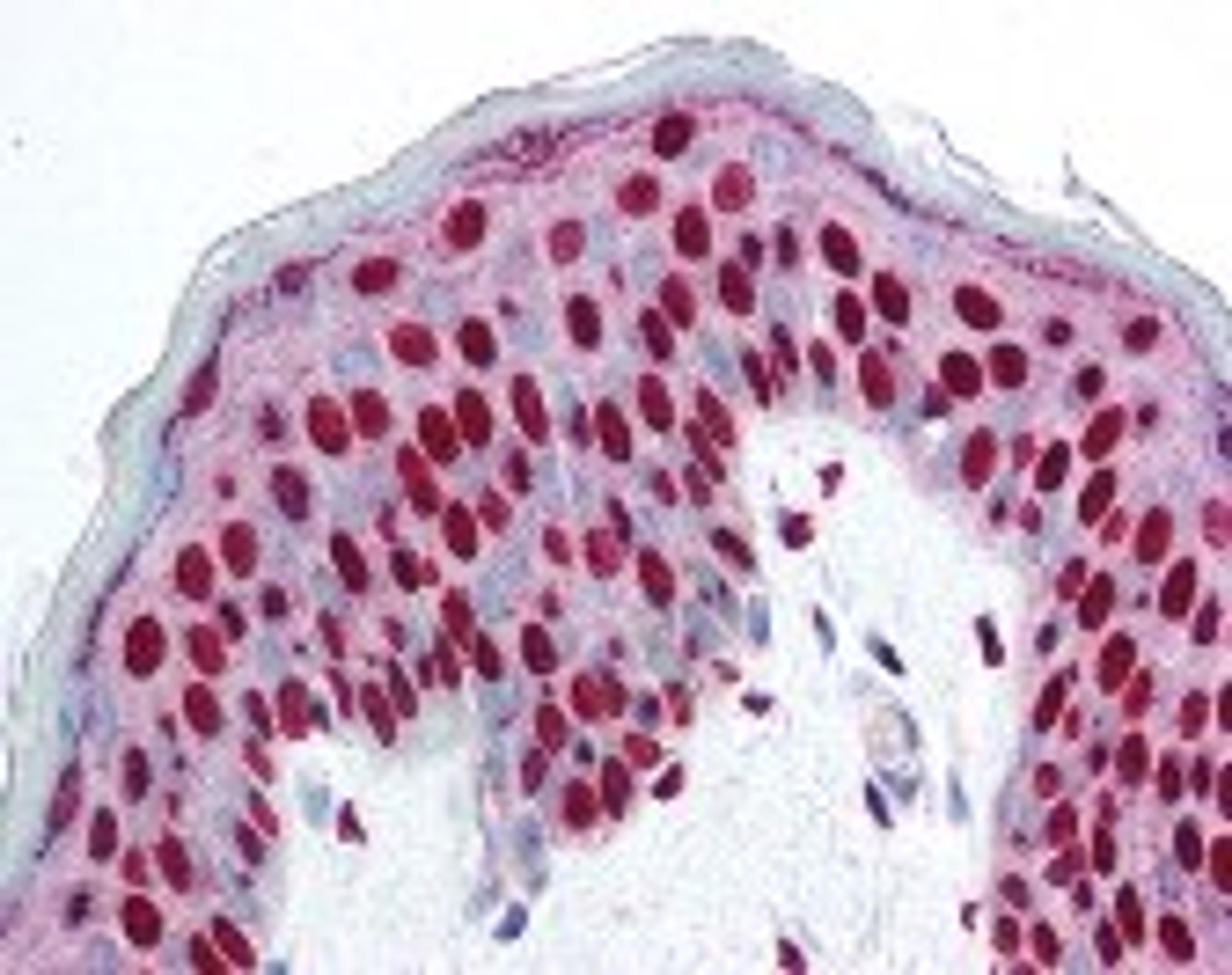 Immunohistochemistry staining of SMAD3 in skin tissue using SMAD3 Antibody.