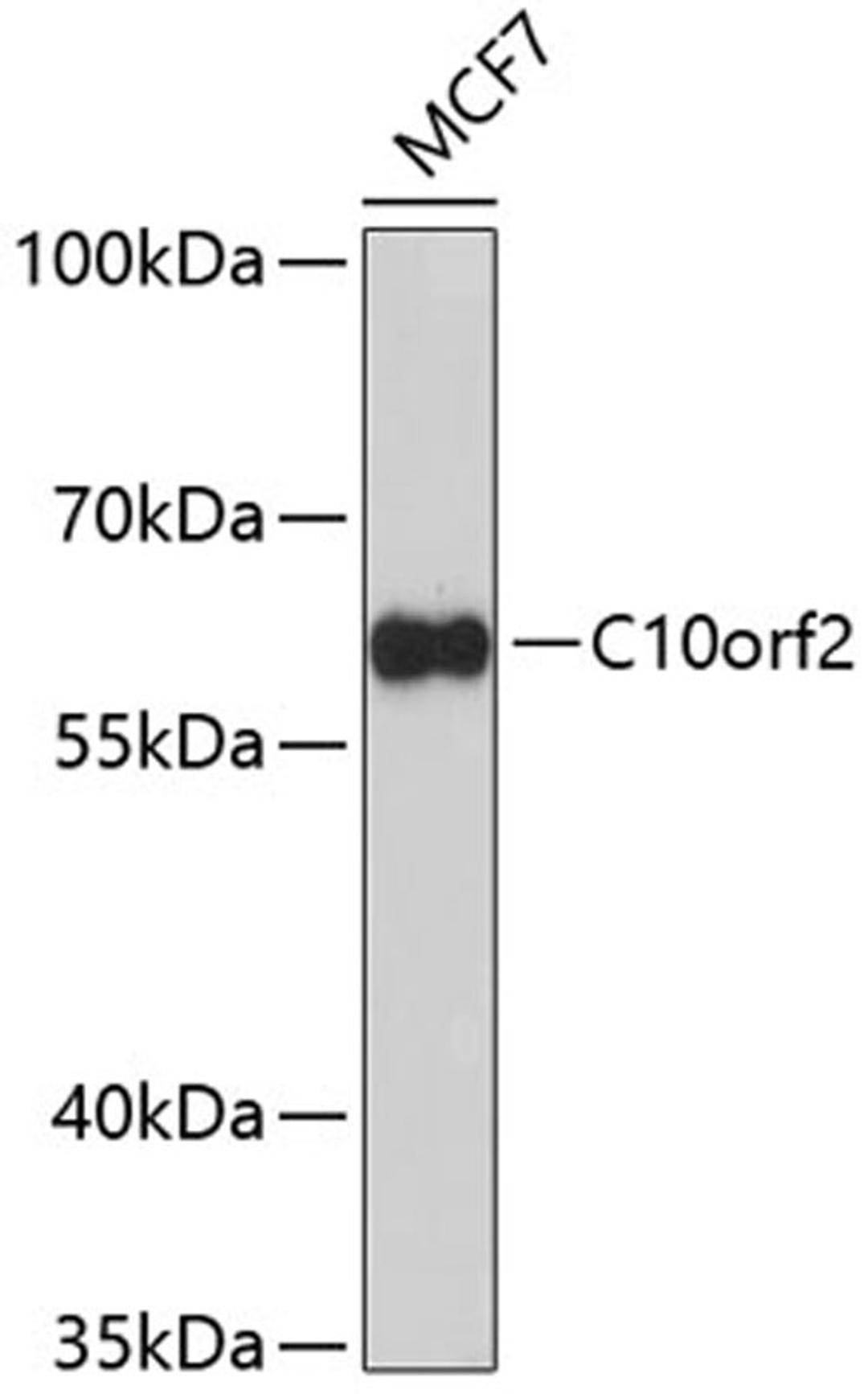 Western blot - C10orf2 Antibody (A5303)