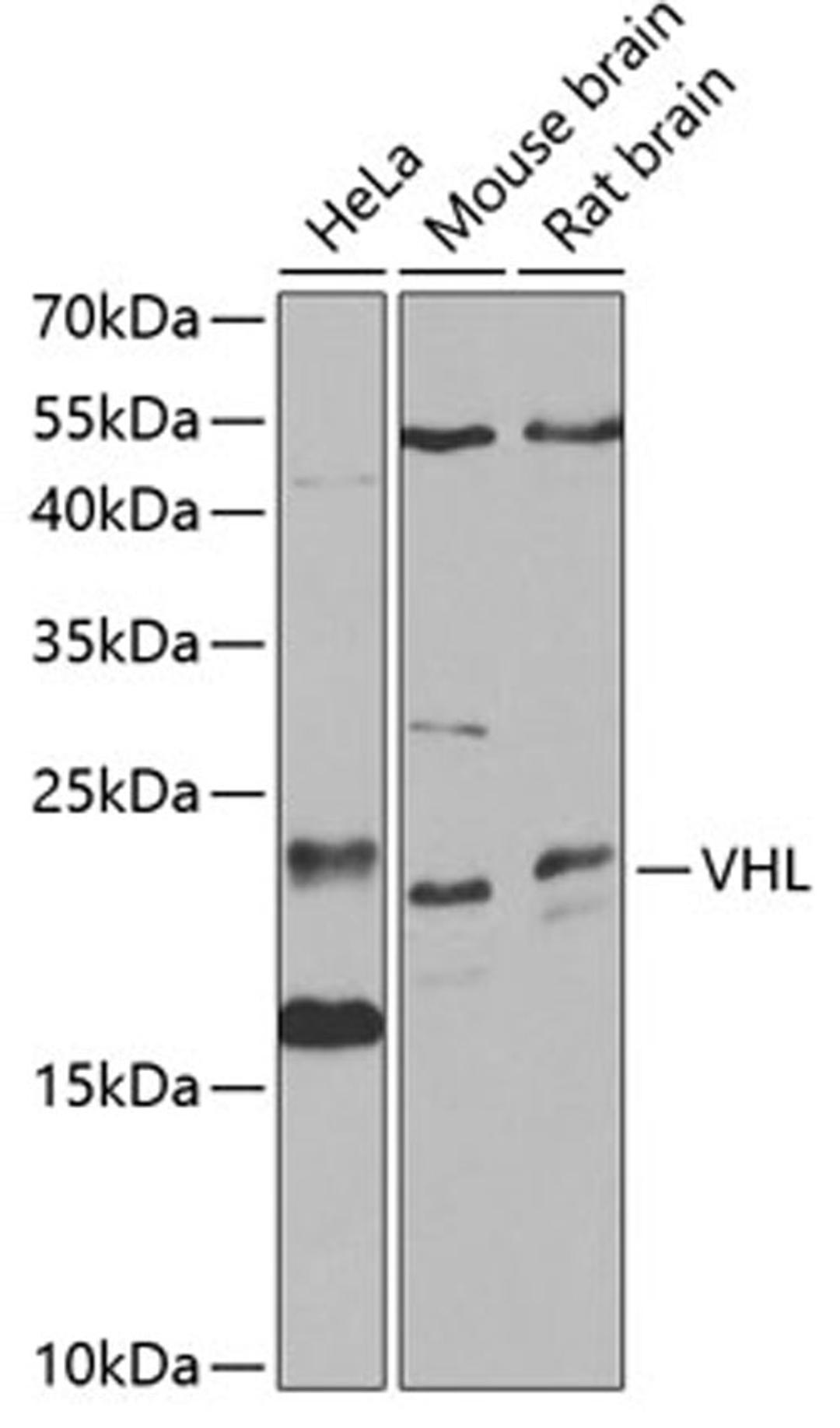 Western blot - VHL antibody (A0377)