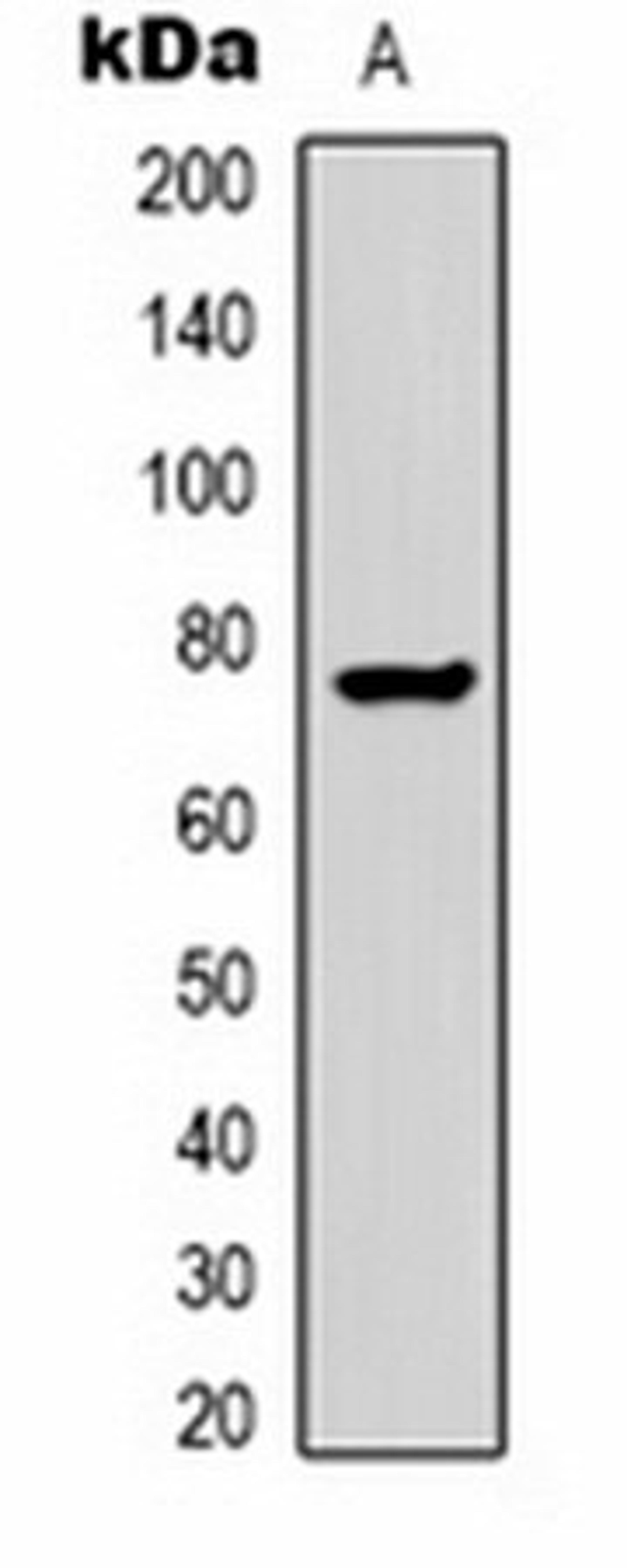 Western blot analysis of  human blood (Lane1) whole cell lysates using Transferrin antibody