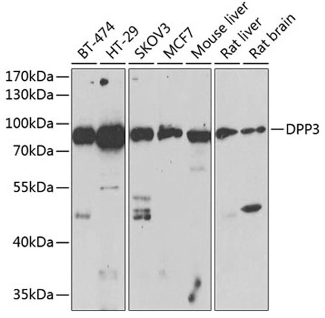 Western blot - DPP3 antibody (A13390)