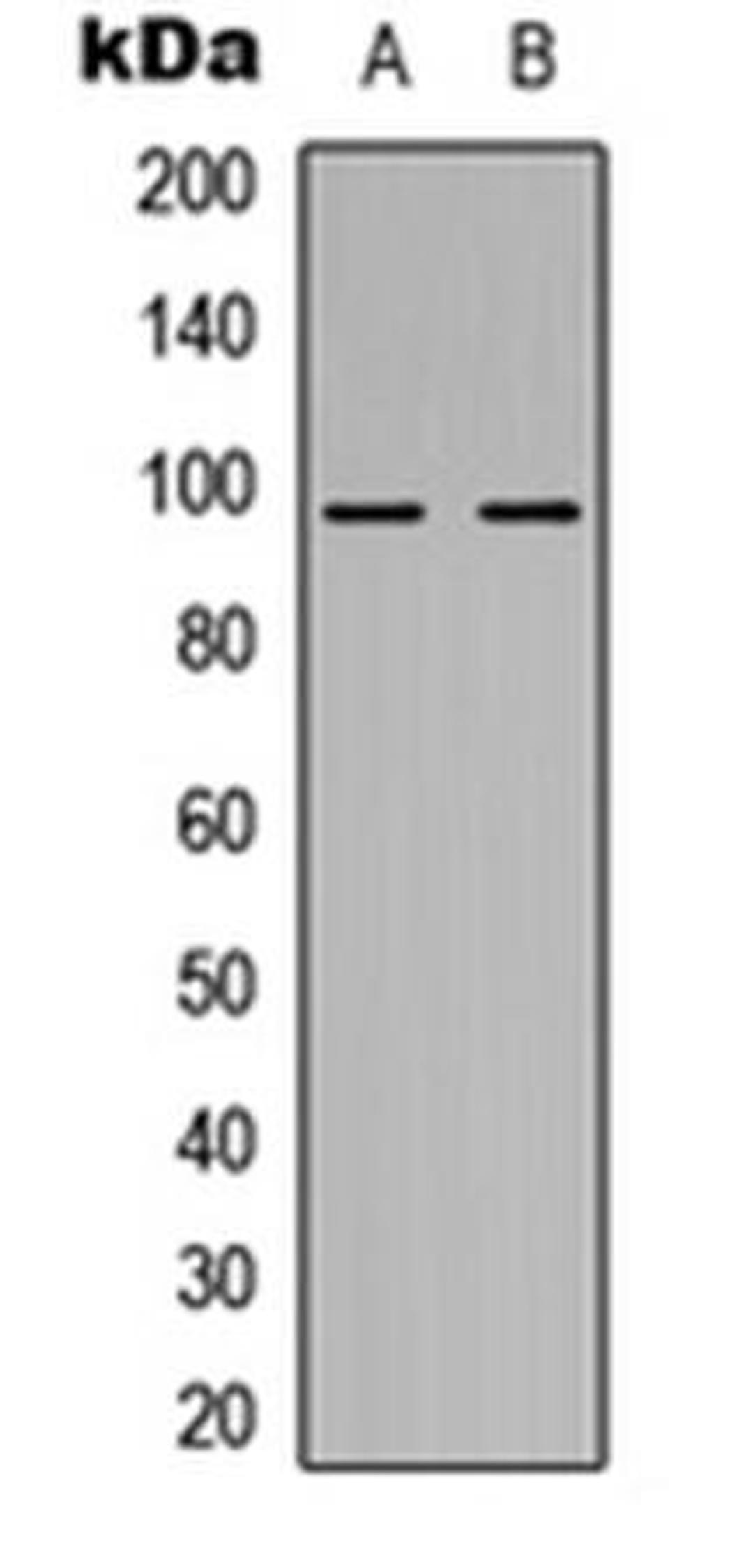 Western blot analysis of HEK293T (Lane1), H9C2 (Lane2) whole cell using NOM1 antibody