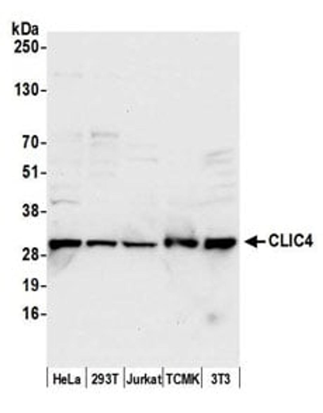 Detection of human and mouse CLIC4 by western blot.