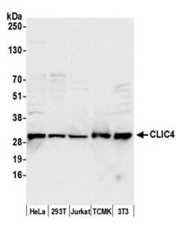 Detection of human and mouse CLIC4 by western blot.