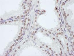 Detection of human WDR4 by immunohistochemistry.