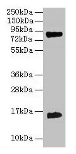 Western blot. All lanes: Hemoglobin polyclonal antibody at 2µg/ml + 293T whole cell lysate. Secondary. Goat polyclonal to rabbit IgG at 1/15000 dilution. Predicted band size: 16 kDa. Observed band size: 16 kDa