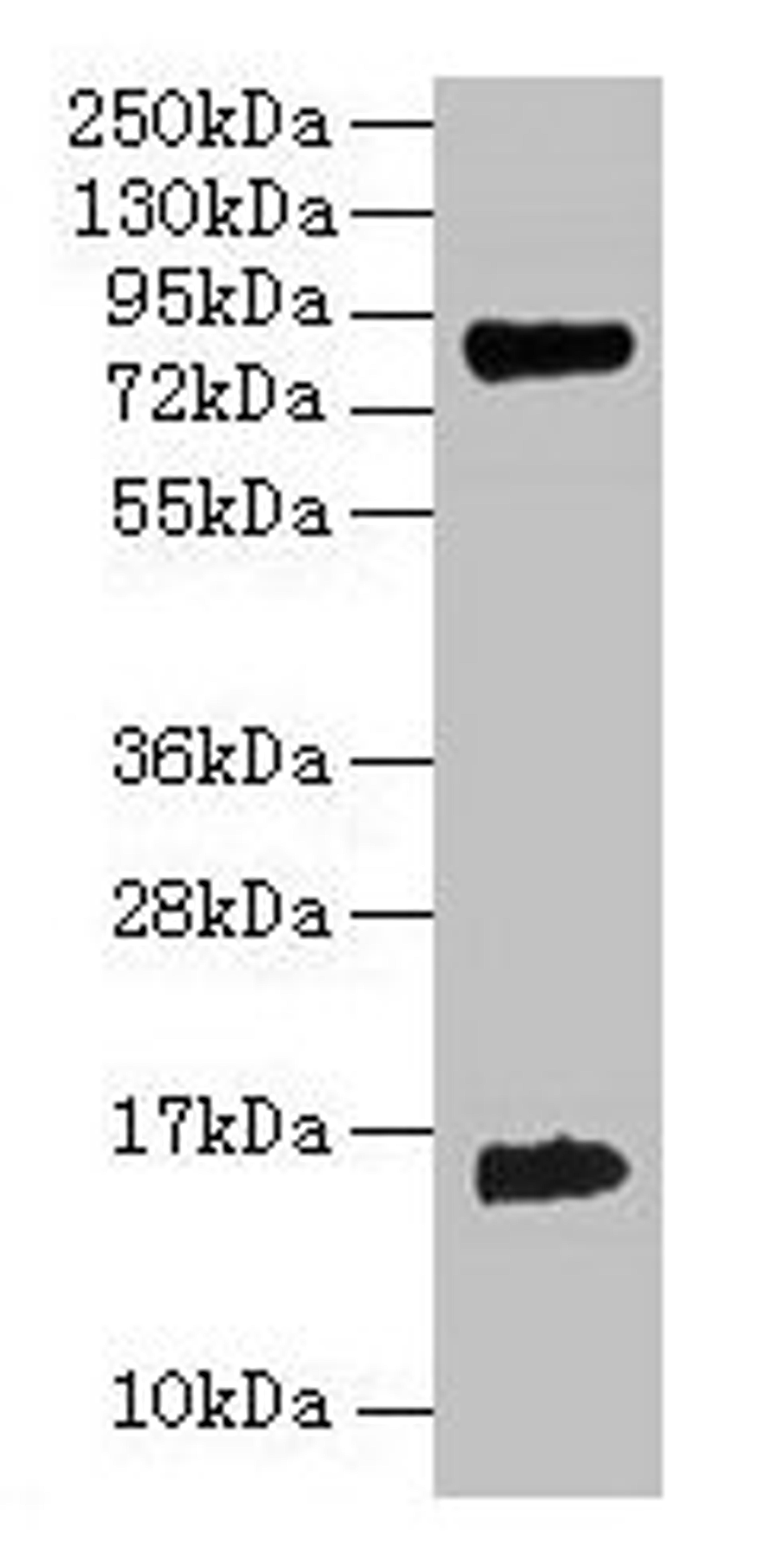 Western blot. All lanes: Hemoglobin polyclonal antibody at 2µg/ml + 293T whole cell lysate. Secondary. Goat polyclonal to rabbit IgG at 1/15000 dilution. Predicted band size: 16 kDa. Observed band size: 16 kDa