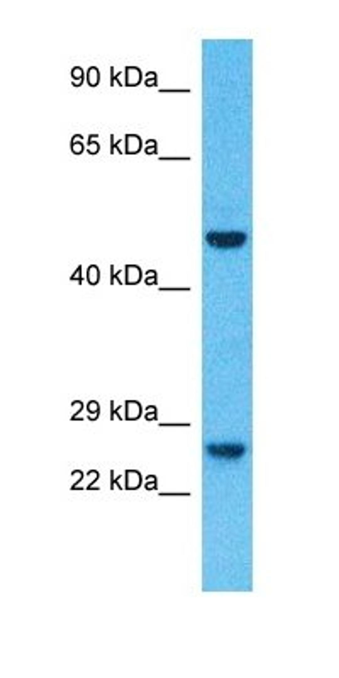 Western blot analysis of human 786-0 Whole Cell tissue using PKHB1 antibody