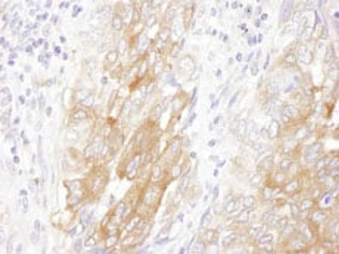 Detection of human LIN28B by immunohistochemistry.