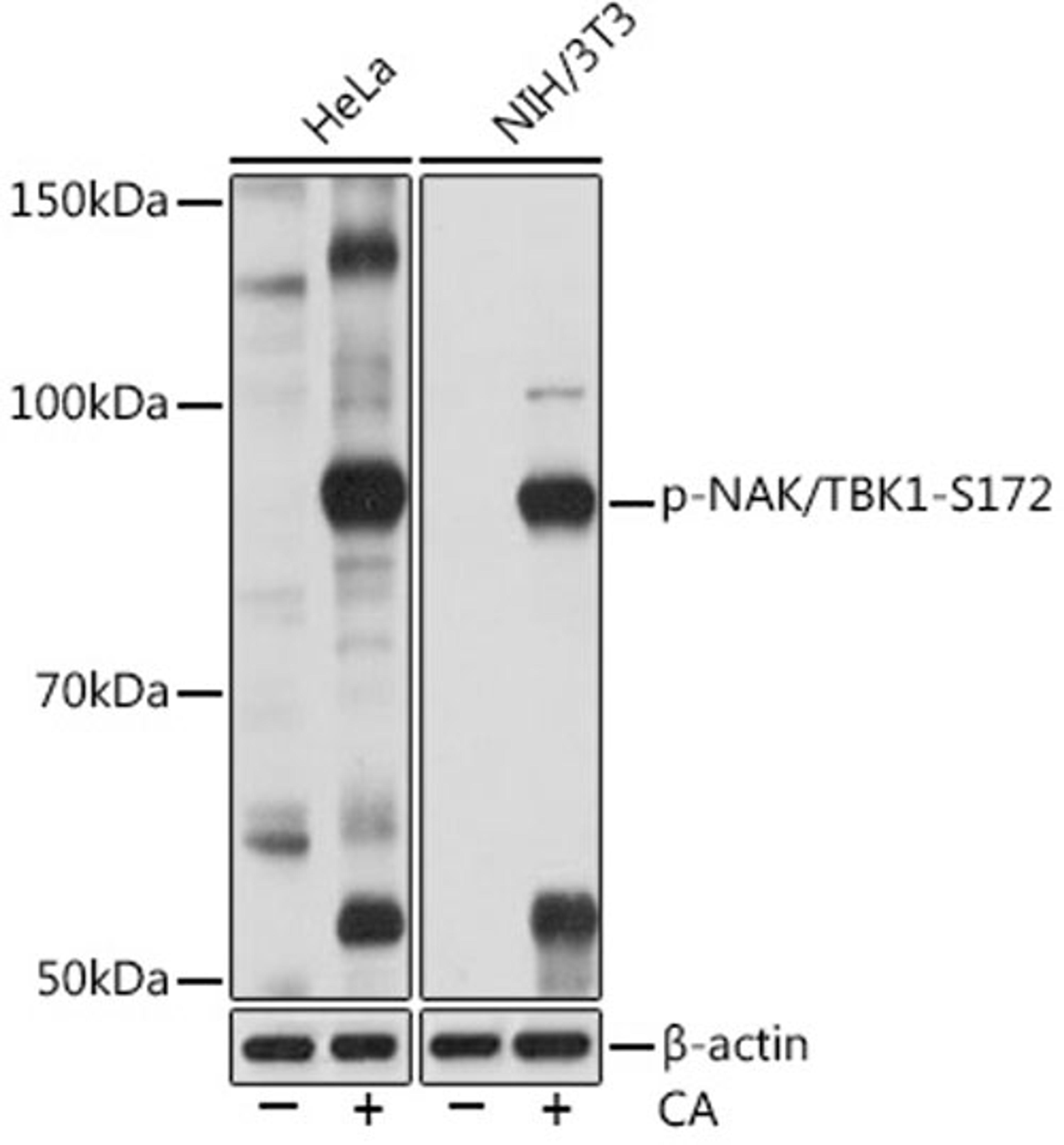 Western blot - Phospho-NAK/TBK1-S172 Rabbit mAb (AP1026)