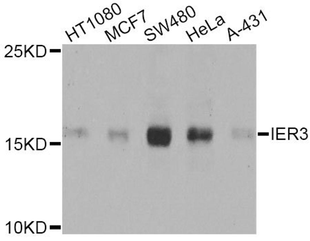 Western blot - IER3 Antibody (A8566)