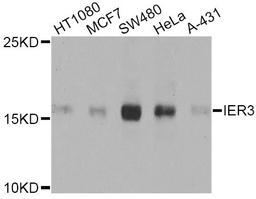 Western blot - IER3 Antibody (A8566)