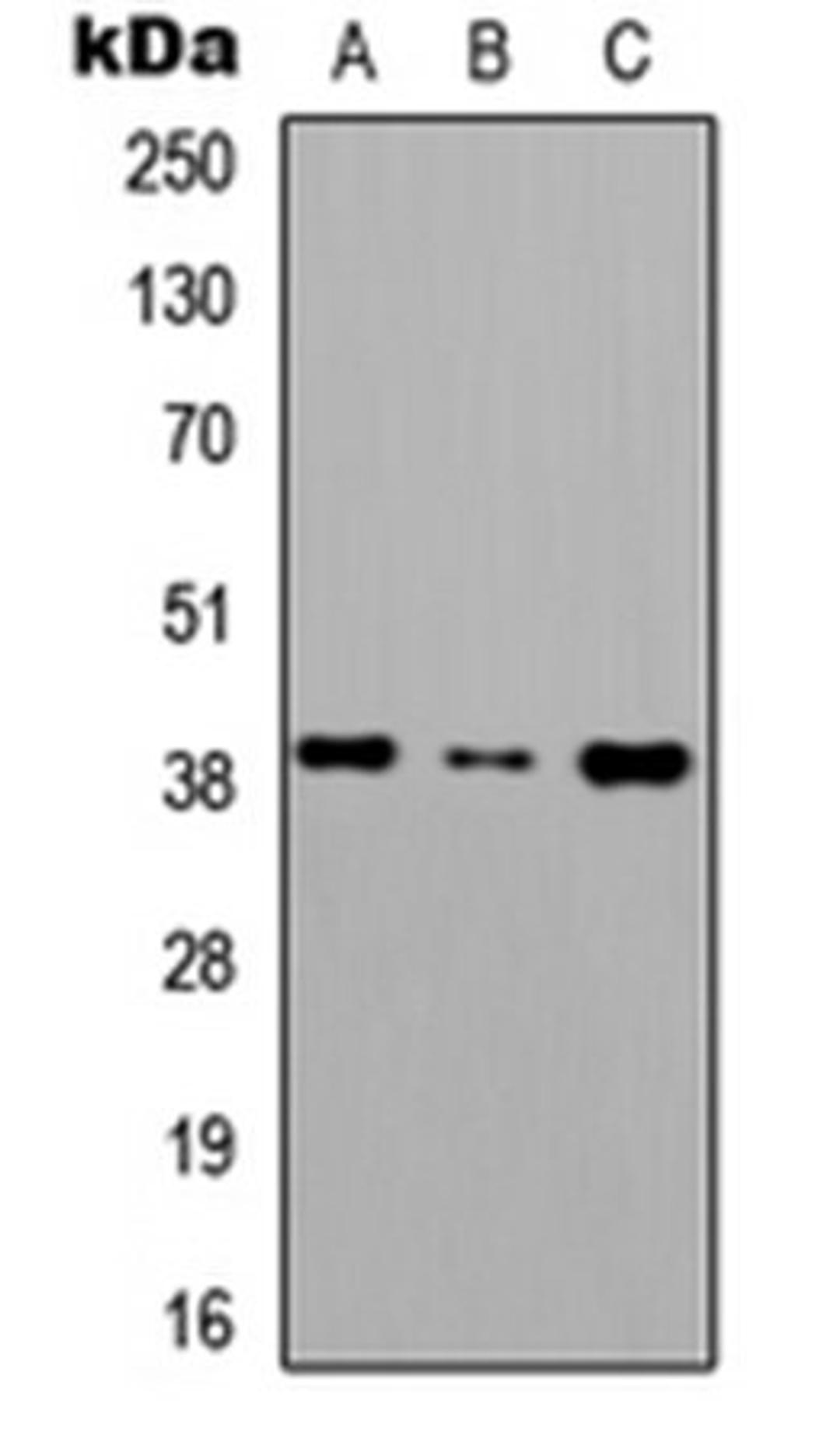 Western blot analysis of HEK293T (Lane1), Raw264.7 (Lane2), H9C2 (Lane3) whole cell using CD186 antibody