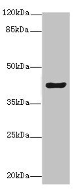 Western blot. All lanes: MEST antibody at 5.78ug/ml + Mouse kidney tissue. Secondary. Goat polyclonal to rabbit IgG at 1/10000 dilution. Predicted band size: 39, 38, 34 kDa. Observed band size: 39 kDa.