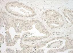 Detection of human NFAT3 by immunohistochemistry.