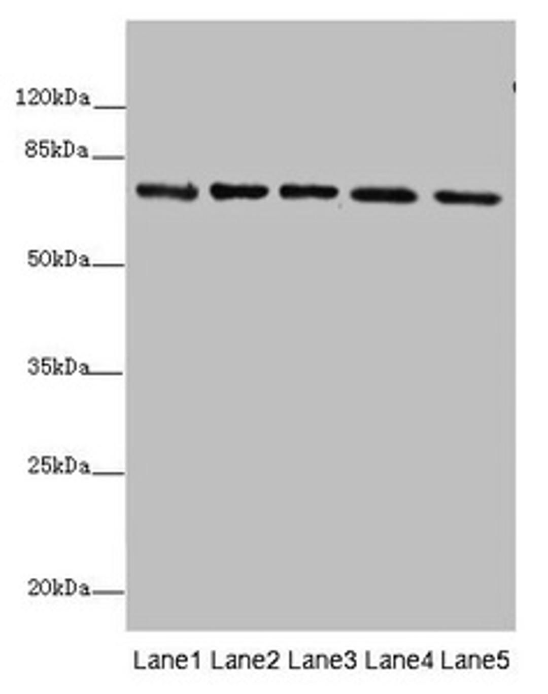 Western blot. All lanes: SDHA antibody at 10µg/ml. Lane 1: Rat heart tissue. Lane 2: Mouse spleen tissue. Lane 3: Mouse liver tissue. Lane 4: Hela whole cell lysate. Lane 5: Zebrafish lysate. Secondary. Goat polyclonal to rabbit IgG at 1/10000 dilution. Predicted band size: 73, 68, 57 kDa. Observed band size: 73 kDa