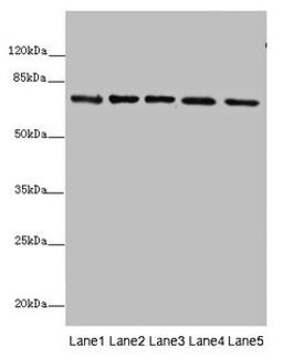 Western blot. All lanes: SDHA antibody at 10µg/ml. Lane 1: Rat heart tissue. Lane 2: Mouse spleen tissue. Lane 3: Mouse liver tissue. Lane 4: Hela whole cell lysate. Lane 5: Zebrafish lysate. Secondary. Goat polyclonal to rabbit IgG at 1/10000 dilution. Predicted band size: 73, 68, 57 kDa. Observed band size: 73 kDa