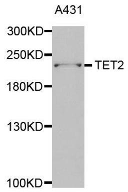 Western blot analysis of extracts of A431 cell line using TET2 antibody