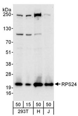 Detection of human RPS24 by western blot.