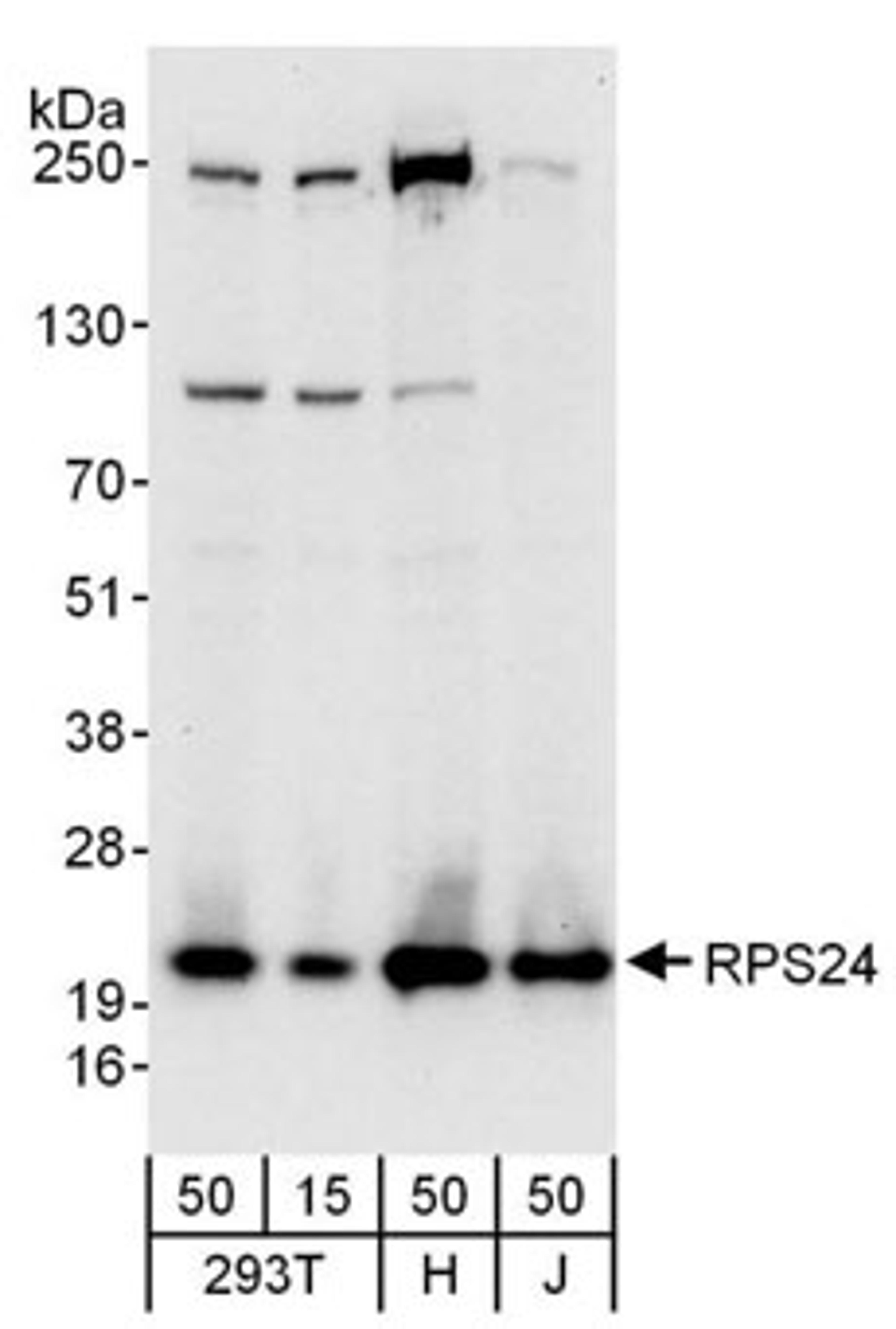 Detection of human RPS24 by western blot.