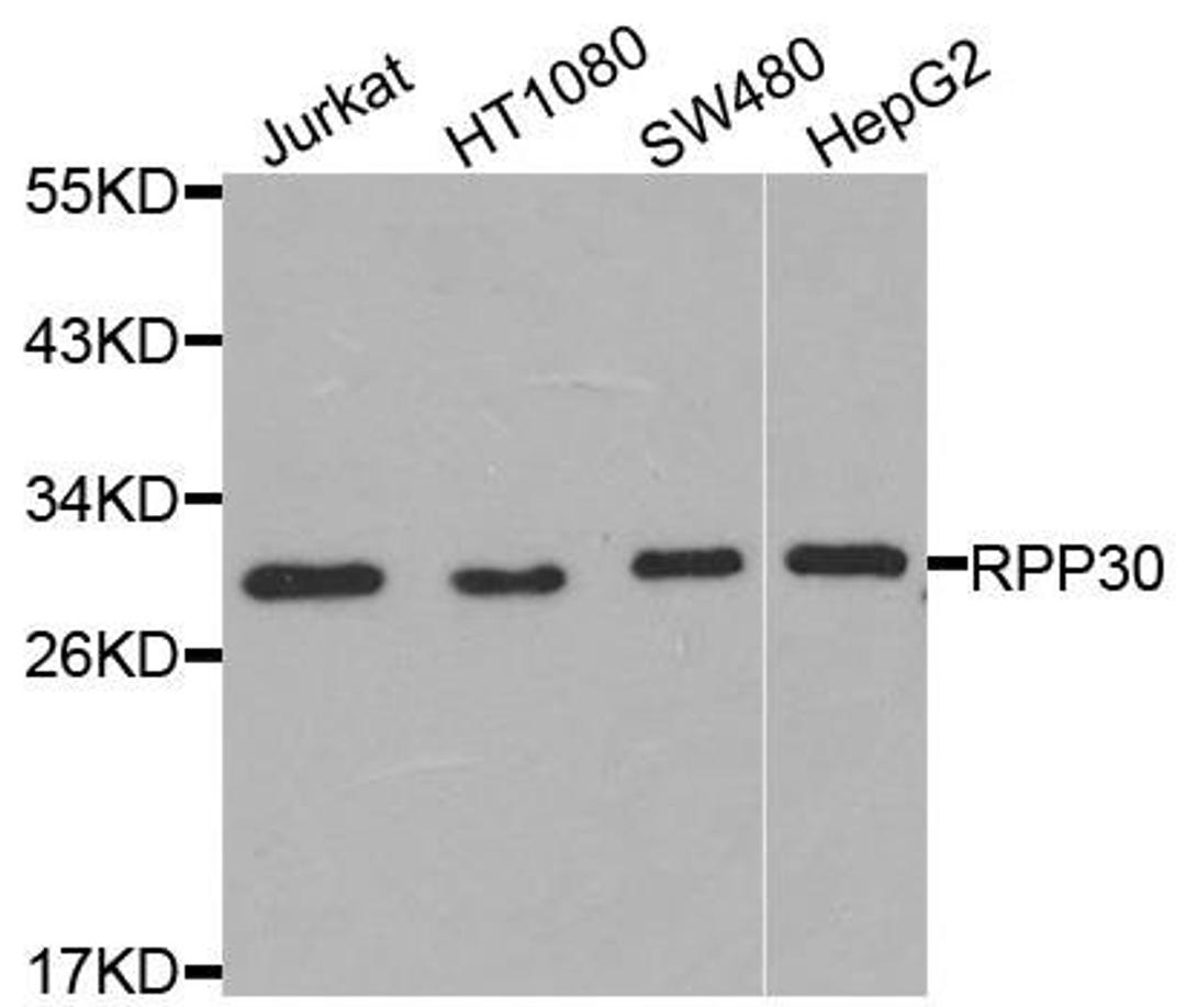 Western blot analysis of extracts of various cells using RPP30 antibody