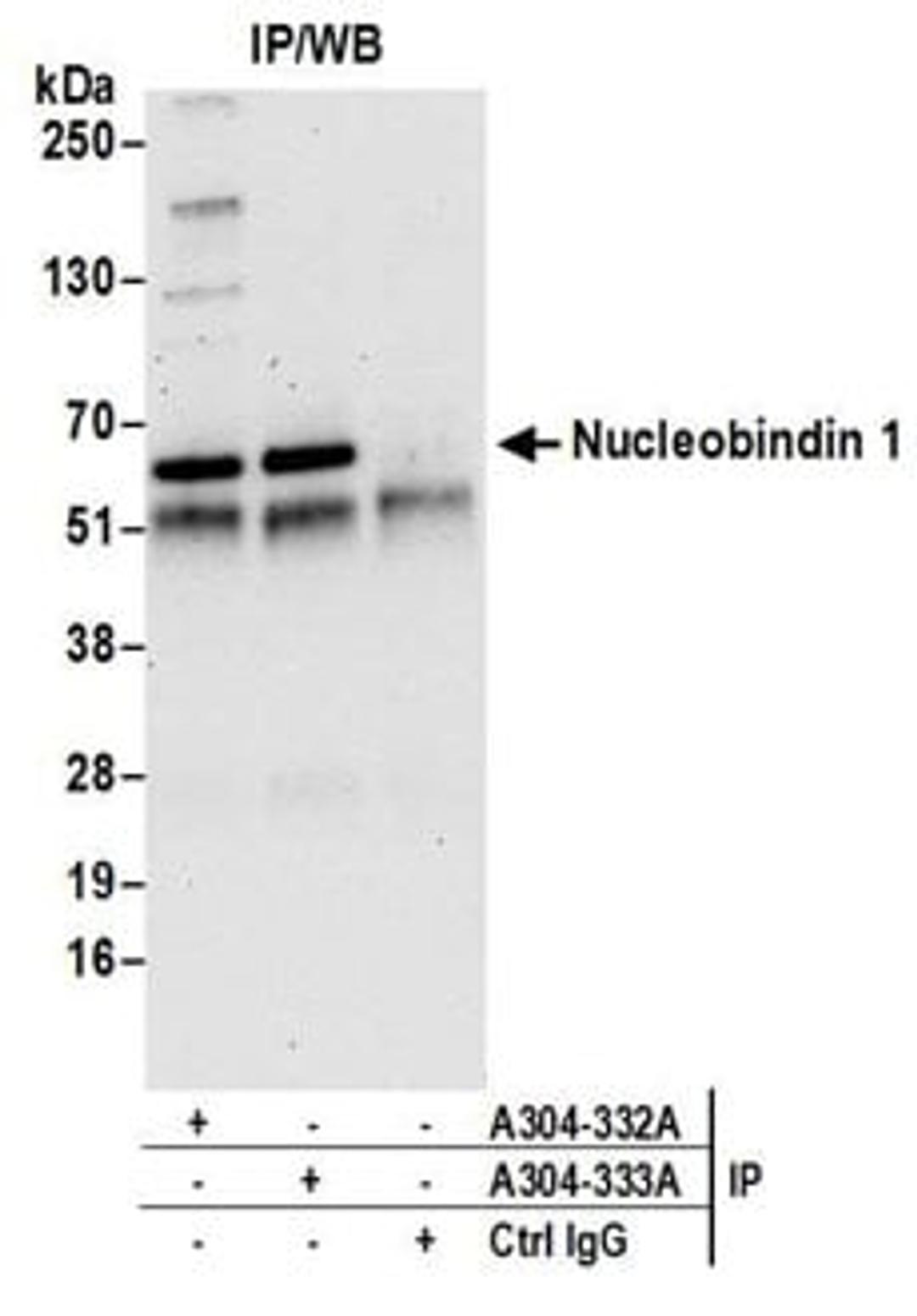 Detection of human Nucleobindin 1 by western blot of immunoprecipitates.