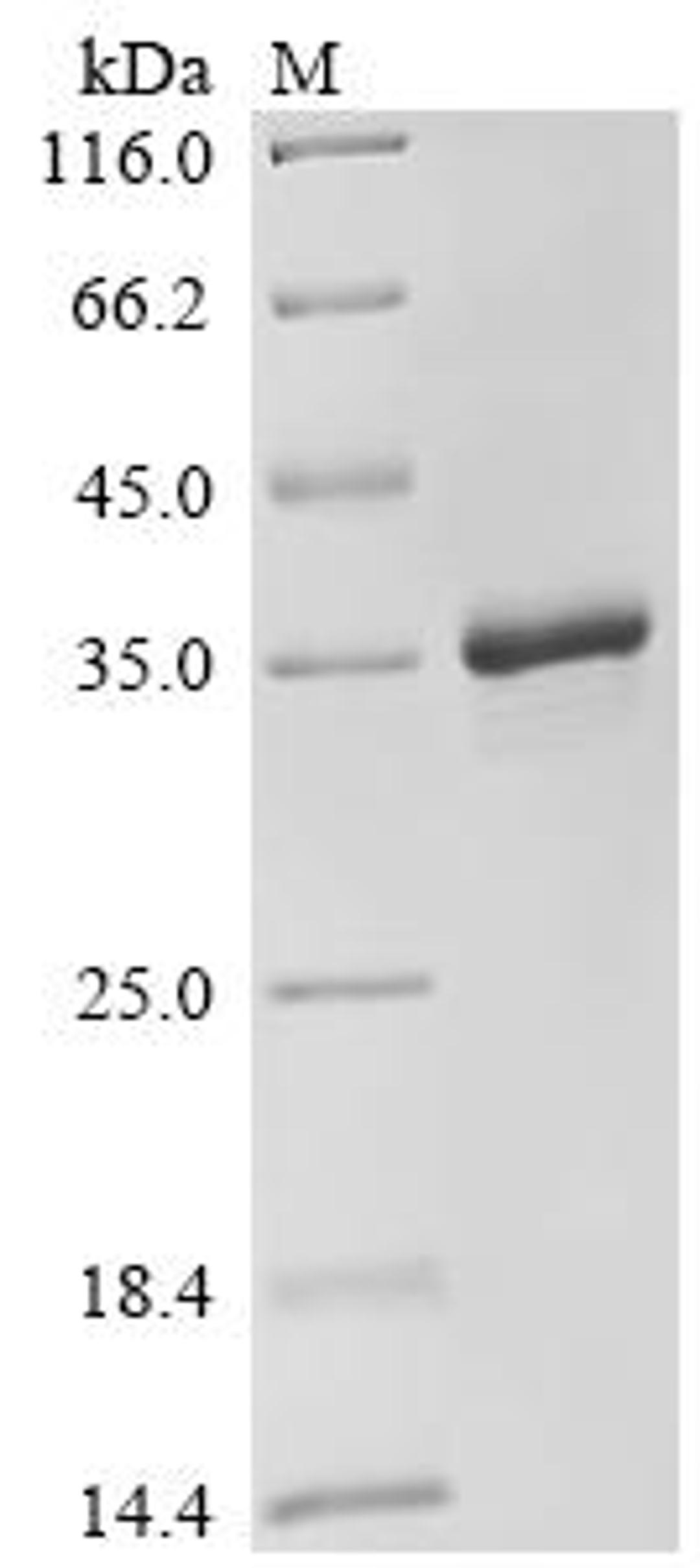 (Tris-Glycine gel) Discontinuous SDS-PAGE (reduced) with 5% enrichment gel and 15% separation gel.