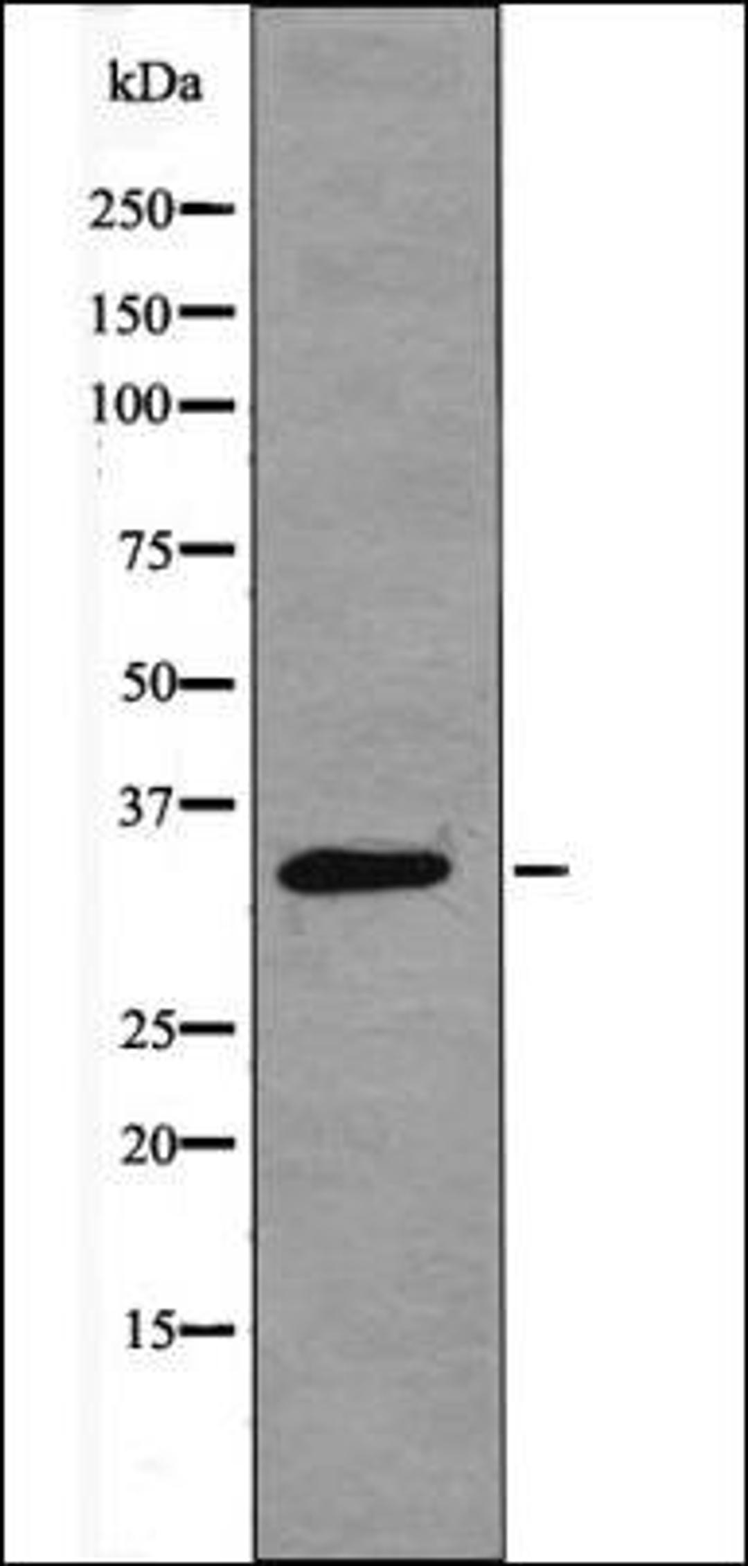 Western blot analysis of K562 whole cell lysates using CDK4 -Phospho-Thr172- antibody