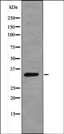 Western blot analysis of K562 whole cell lysates using CDK4 -Phospho-Thr172- antibody