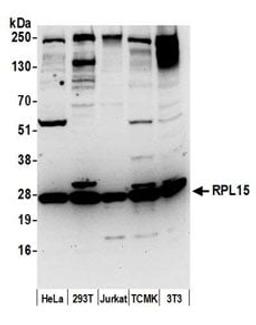 Detection of human and mouse RPL15 by western blot.