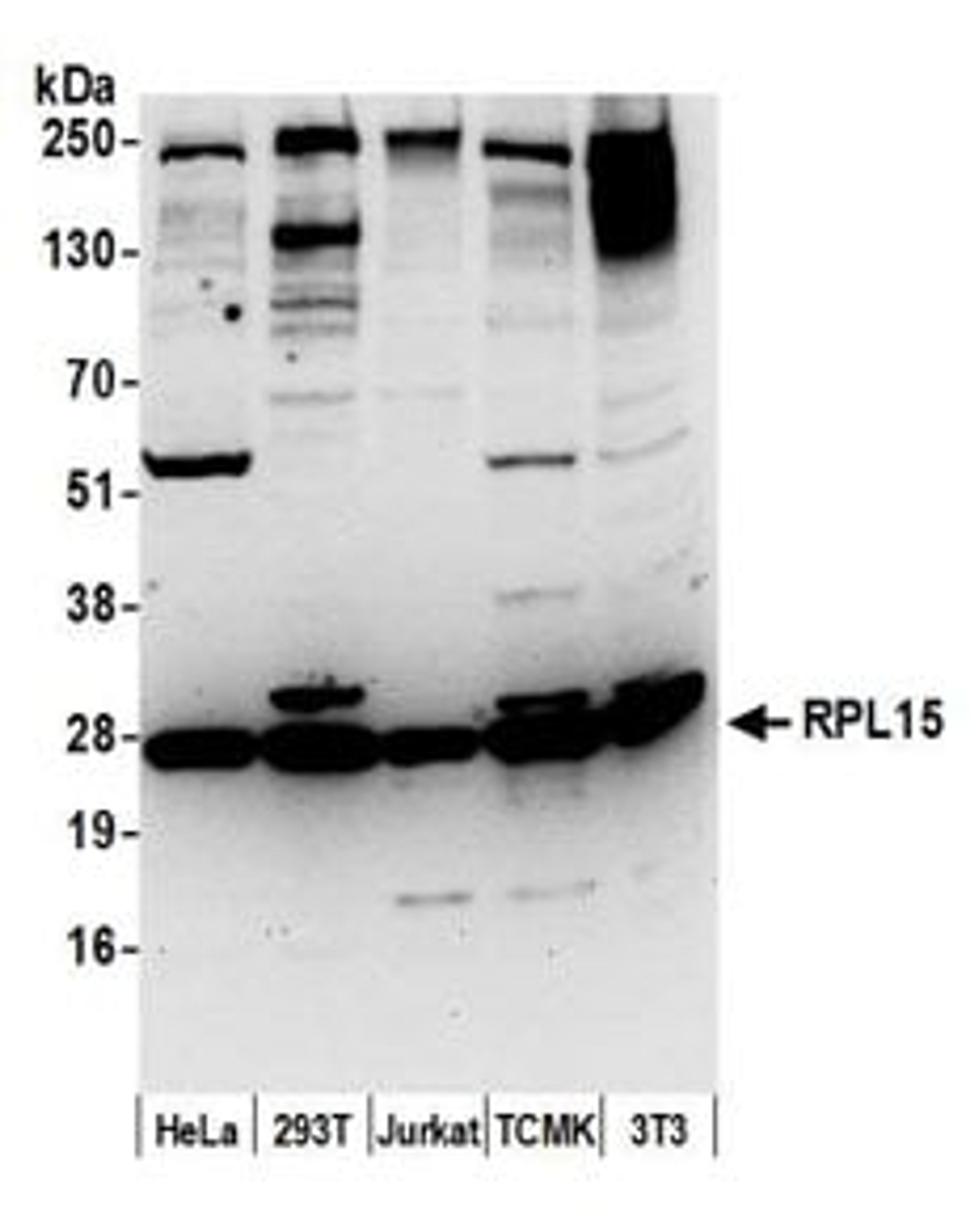 Detection of human and mouse RPL15 by western blot.