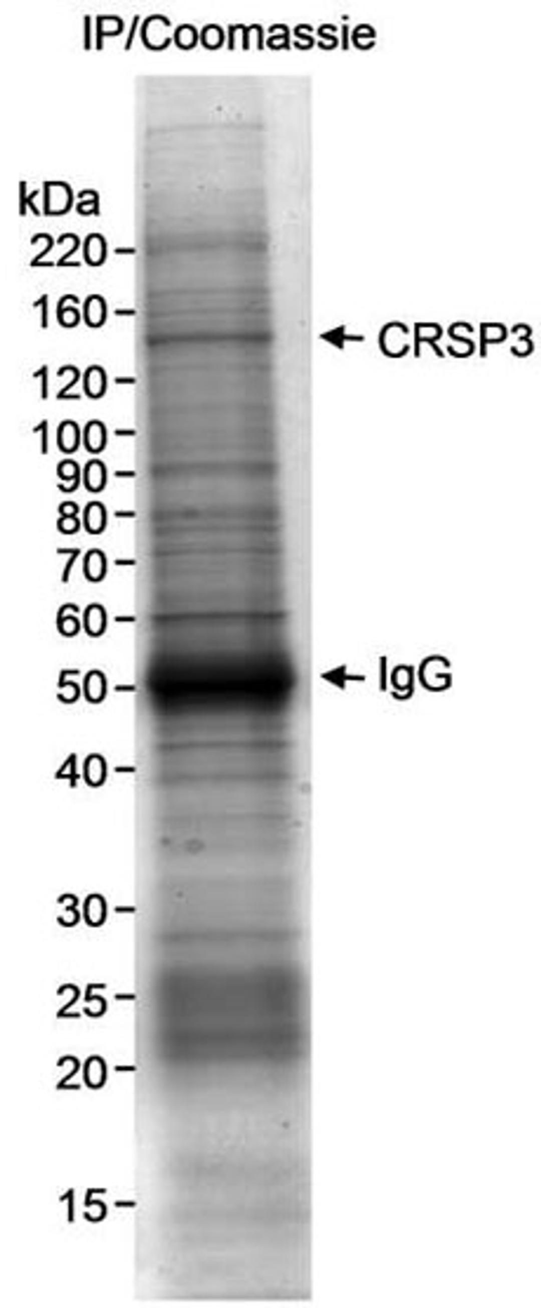 Detection of human CRSP3 by immunoprecipitation.