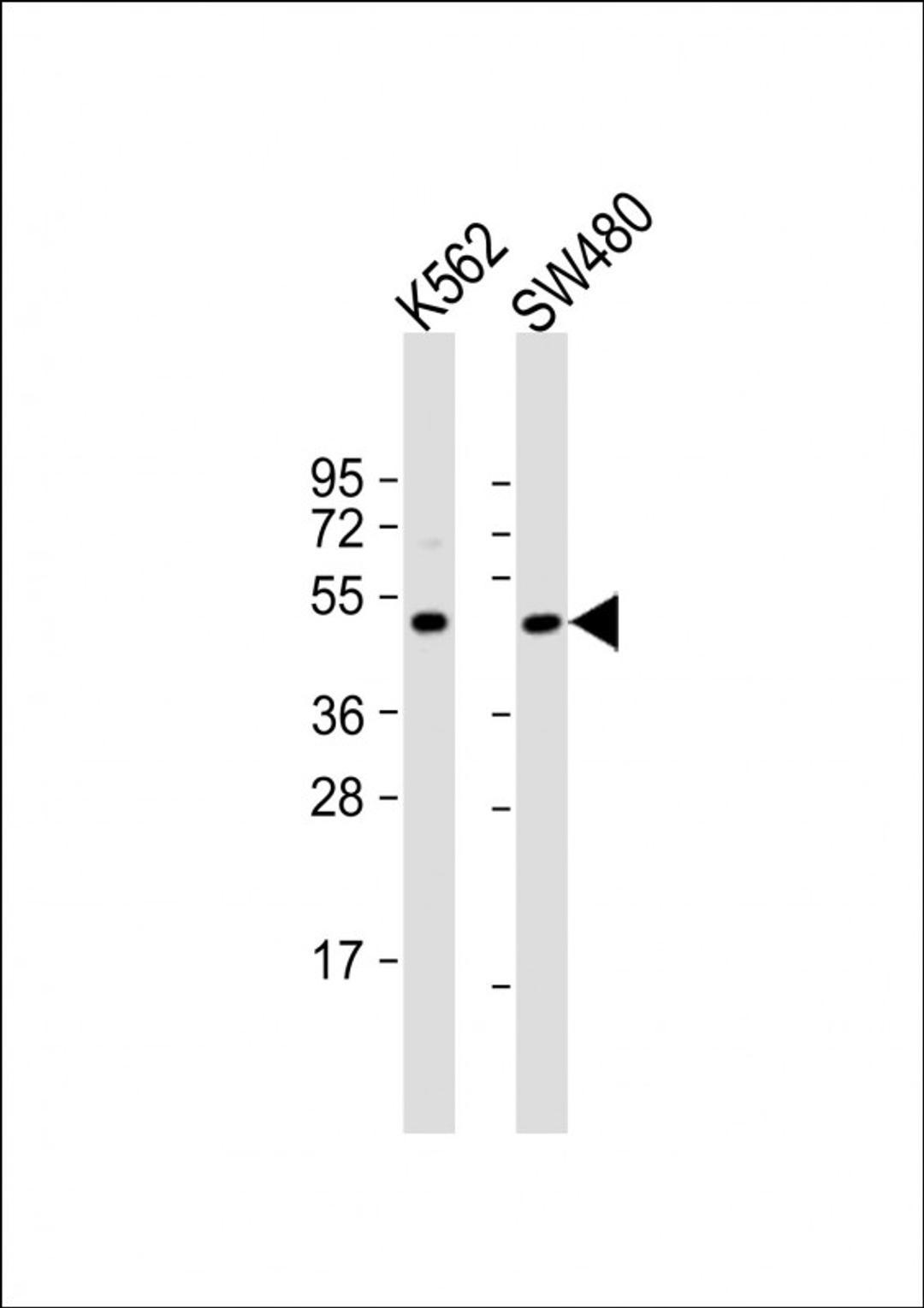 Western Blot at 1:1000 dilution Lane 1: K562 whole cell lysate Lane 2: SW480 whole cell lysate Lysates/proteins at 20 ug per lane.