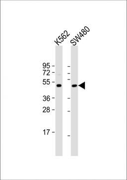 Western Blot at 1:1000 dilution Lane 1: K562 whole cell lysate Lane 2: SW480 whole cell lysate Lysates/proteins at 20 ug per lane.