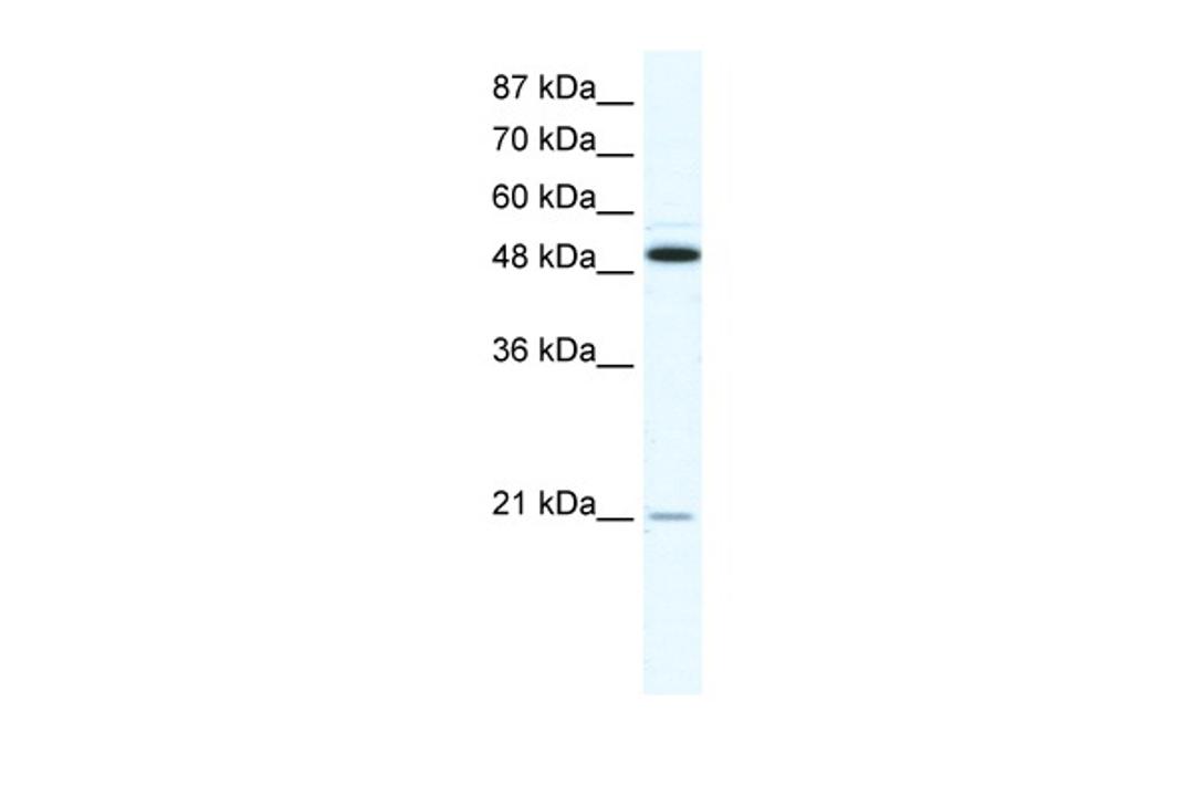 Antibody used in WB on Human HepG2 at 1.25 ug/ml.