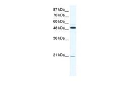 Antibody used in WB on Human HepG2 at 1.25 ug/ml.