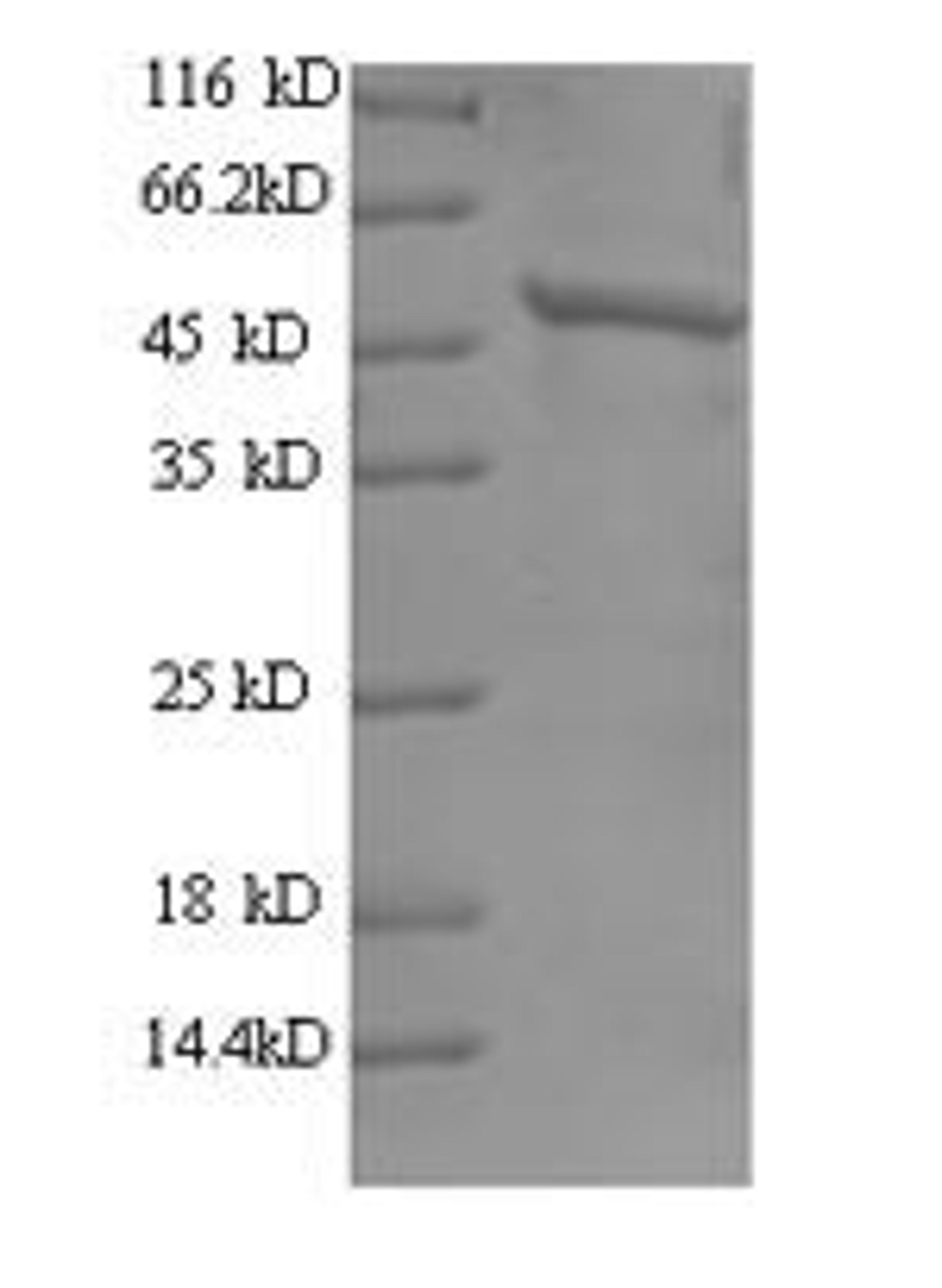 (Tris-Glycine gel) Discontinuous SDS-PAGE (reduced) with 5% enrichment gel and 15% separation gel.