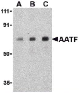 Western blot analysis of AATF in human small intestine cell lysate with AATF antibody at (A) 0.5, (B) 1 and (C) 2 &#956;g/mL.