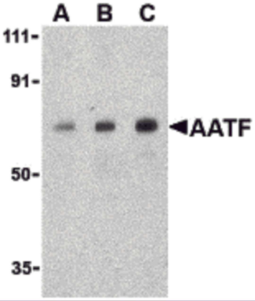 Western blot analysis of AATF in human small intestine cell lysate with AATF antibody at (A) 0.5, (B) 1 and (C) 2 μg/mL.