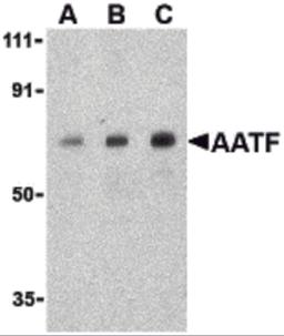 Western blot analysis of AATF in human small intestine cell lysate with AATF antibody at (A) 0.5, (B) 1 and (C) 2 μg/mL.